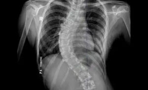 Xray 600x365 pix